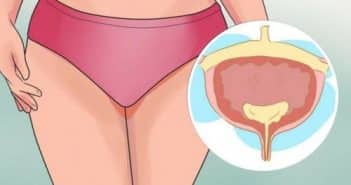 Quels aliments irritent la vessie ?